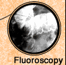 Fluoroscopy